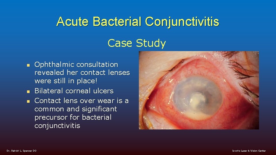 Acute Bacterial Conjunctivitis Case Study n n n Ophthalmic consultation revealed her contact lenses