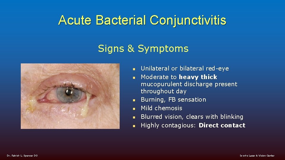 Acute Bacterial Conjunctivitis Signs & Symptoms n n n Dr. Patrick L. Spencer DO