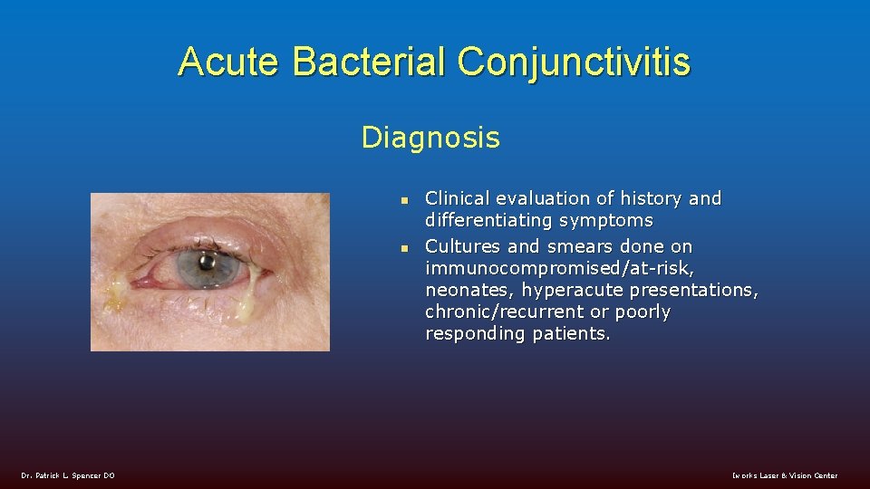 Acute Bacterial Conjunctivitis Diagnosis n n Dr. Patrick L. Spencer DO Clinical evaluation of