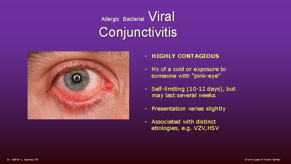 Viral Conjunctivitis Allergic Bacterial • HIGHLY CONTAGIOUS • Hx of a cold or exposure