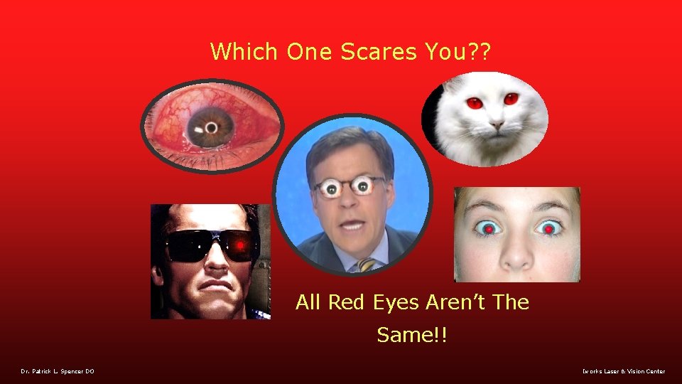 Which One Scares You? ? All Red Eyes Aren’t The Same!! Dr. Patrick L.