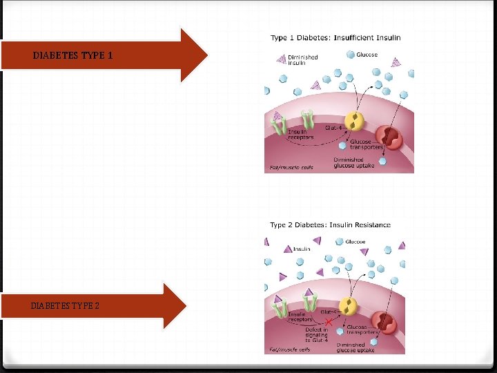 DIABETES TYPE 1 DIABETES TYPE 2 