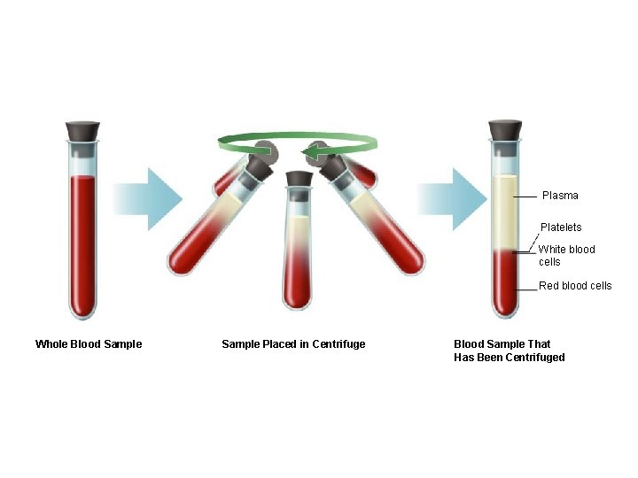 Plasma Platelets White blood cells Red blood cells Whole Blood Sample Placed in Centrifuge