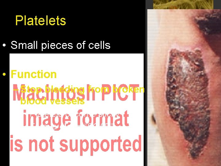 Platelets • Small pieces of cells floating in blood • Function – Stop bleeding