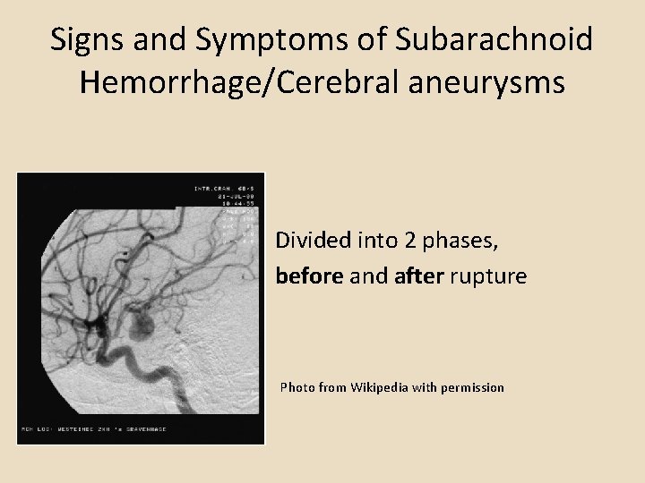 Signs and Symptoms of Subarachnoid Hemorrhage/Cerebral aneurysms Divided into 2 phases, before and after