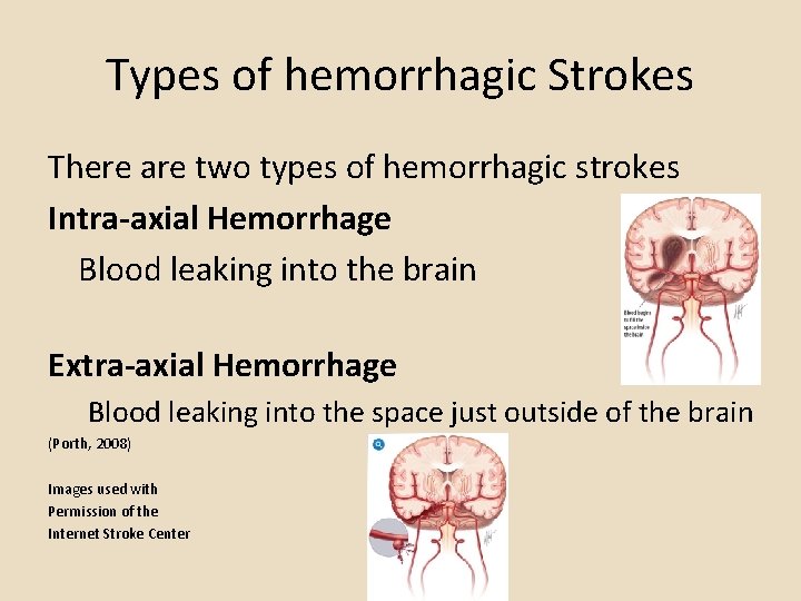 Types of hemorrhagic Strokes There are two types of hemorrhagic strokes Intra-axial Hemorrhage Blood