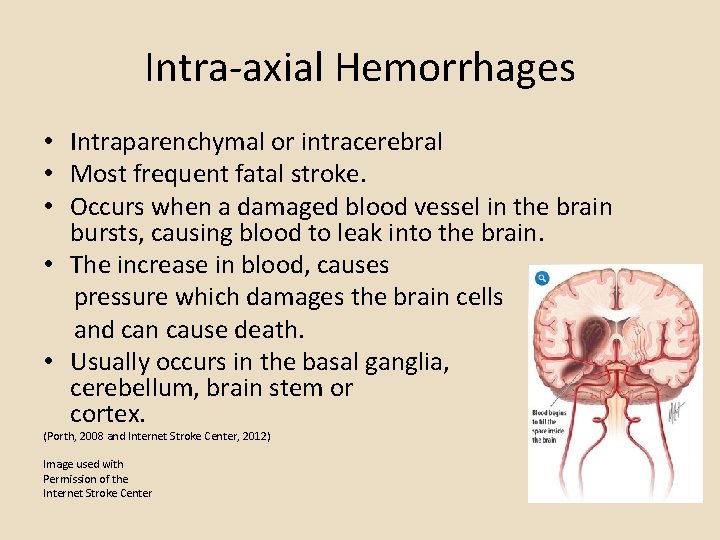 Intra-axial Hemorrhages • Intraparenchymal or intracerebral • Most frequent fatal stroke. • Occurs when