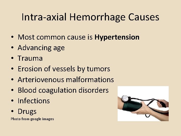 Intra-axial Hemorrhage Causes • • Most common cause is Hypertension Advancing age Trauma Erosion