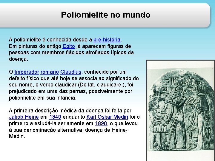 Poliomielite no mundo A poliomielite é conhecida desde a pré-história. Em pinturas do antigo