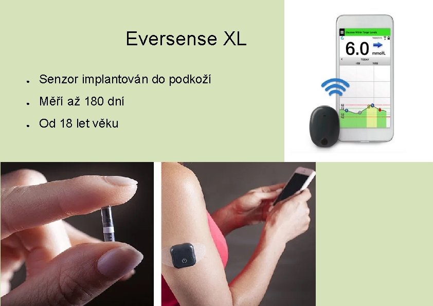 Eversense XL ● Senzor implantován do podkoží ● Měří až 180 dní ● Od