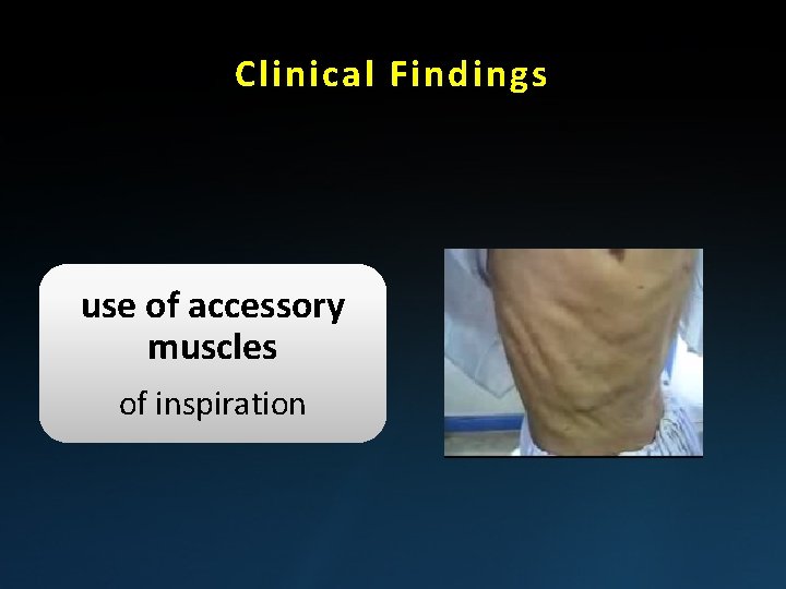 Clinical Findings use of accessory muscles of inspiration 