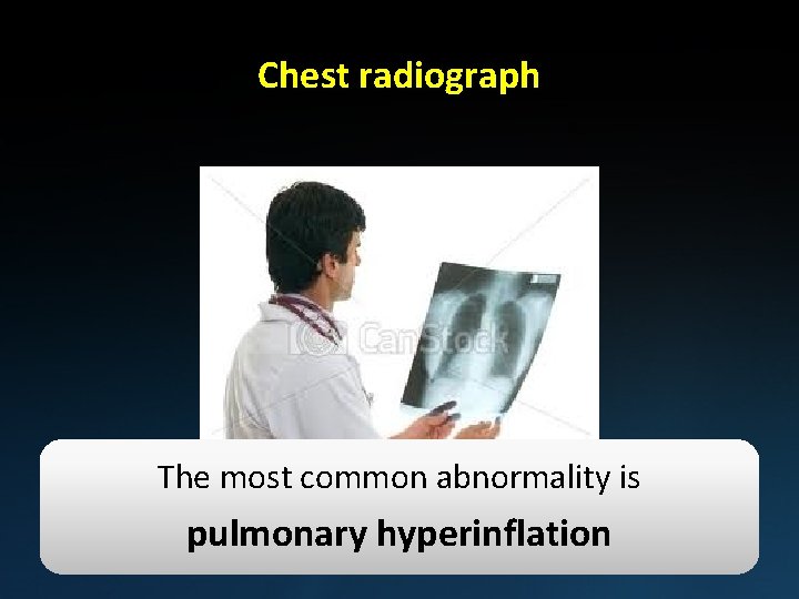 Chest radiograph The most common abnormality is pulmonary hyperinflation 