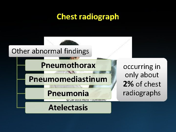 Chest radiograph Other abnormal findings Pneumothorax Pneumomediastinum Pneumonia Atelectasis occurring in only about 2%