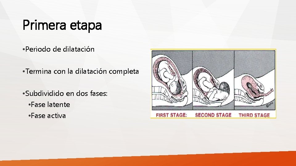 Primera etapa • Periodo de dilatación • Termina con la dilatación completa • Subdividido