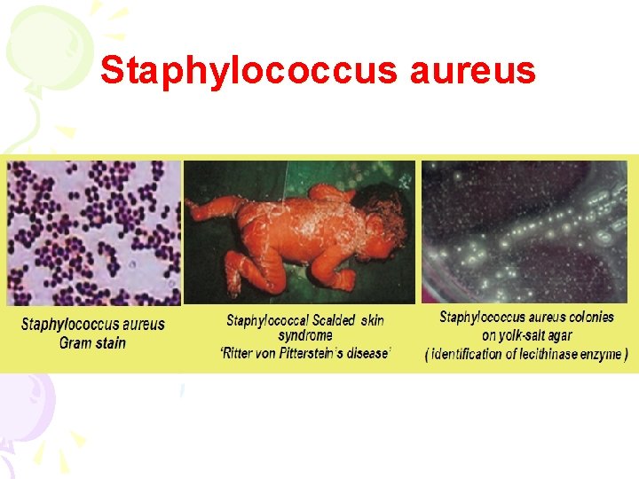 Staphylococcus aureus 