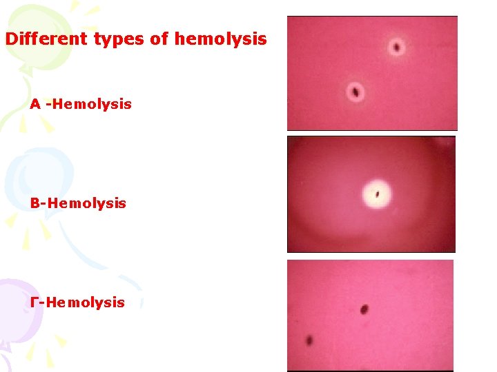 Different types of hemolysis Α -Hemolysis Β-Hemolysis Γ-Hemolysis 