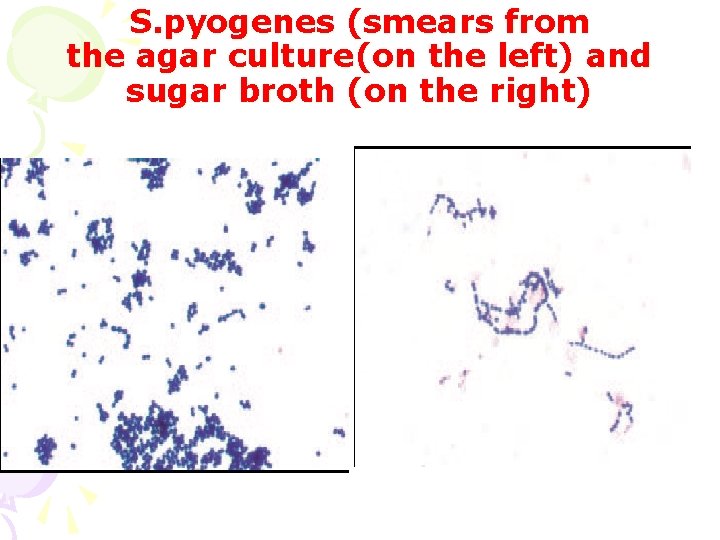 S. pyogenes (smears from the agar culture(on the left) and sugar broth (on the