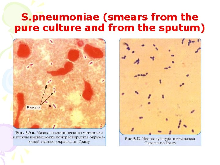 S. pneumoniae (smears from the pure culture and from the sputum) 