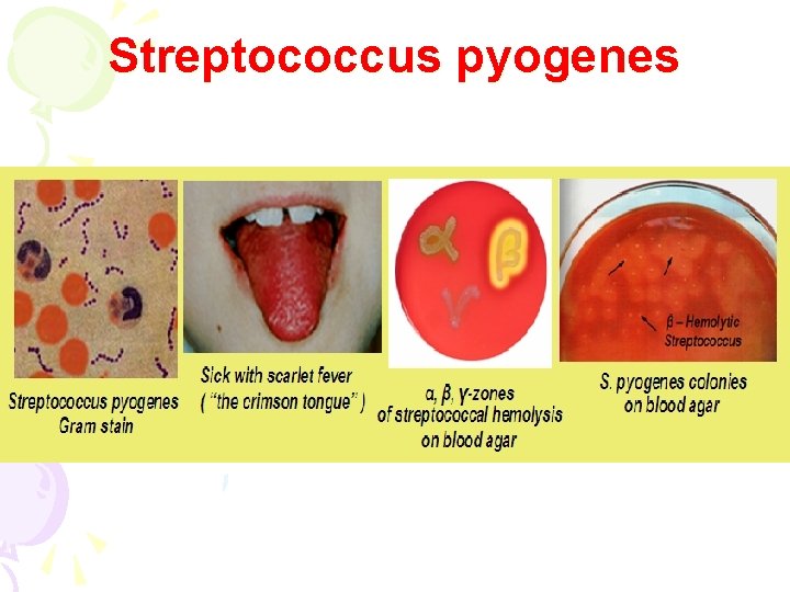 Streptococcus pyogenes 