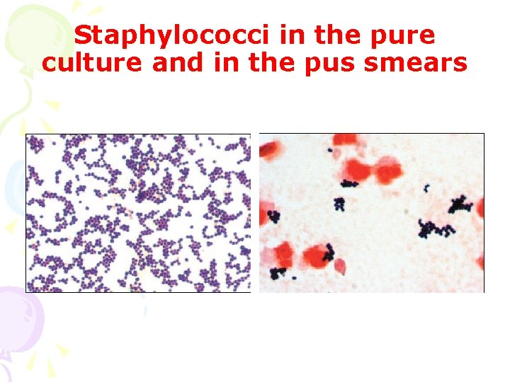 Staphylococci in the pure culture and in the pus smears 