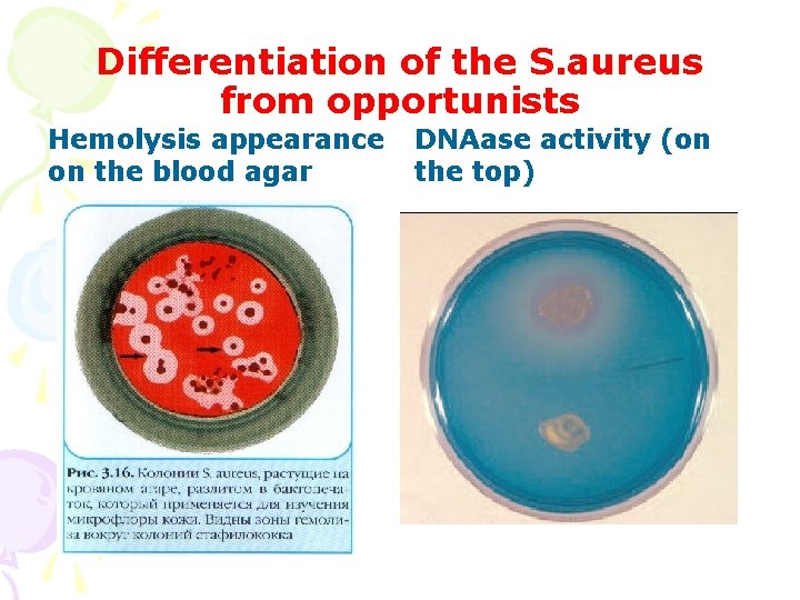 Differentiation of the S. aureus from opportunists Hemolysis appearance on the blood agar DNAase