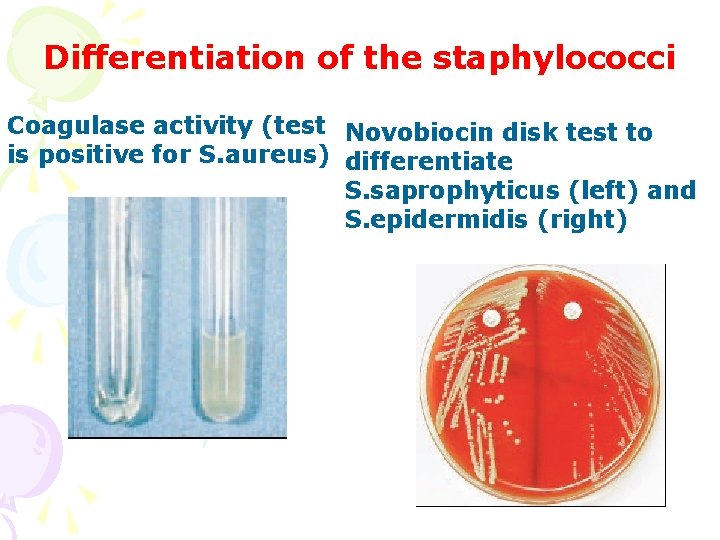 Differentiation of the staphylococci Coagulase activity (test Novobiocin disk test to is positive for