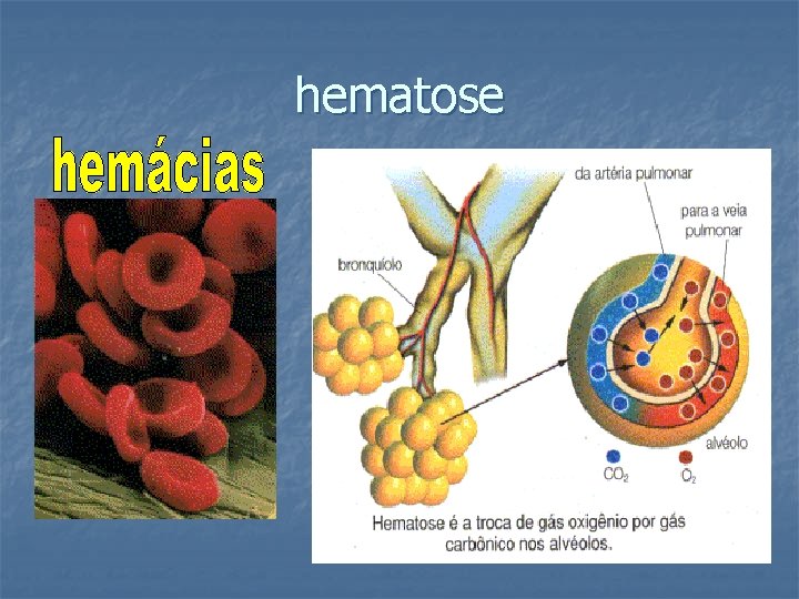 hematose 