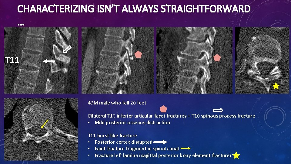 CHARACTERIZING ISN’T ALWAYS STRAIGHTFORWARD … T 11 43 M male who fell 20 feet