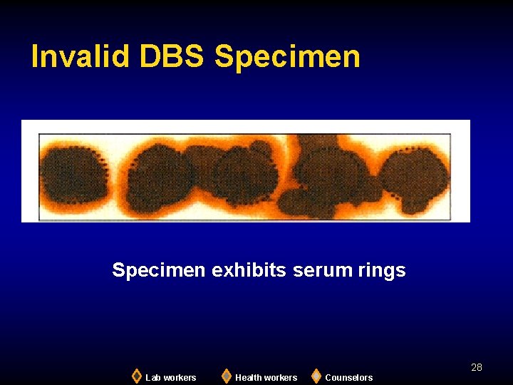 Invalid DBS Specimen exhibits serum rings 28 Lab workers Health workers Counselors 