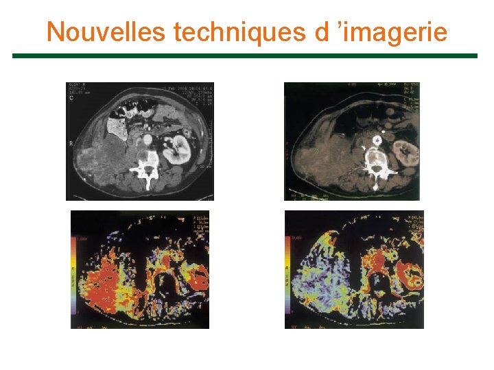 Nouvelles techniques d ’imagerie 