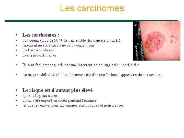 Les carcinomes • Les carcinomes : • • nombreux (plus de 90 % de