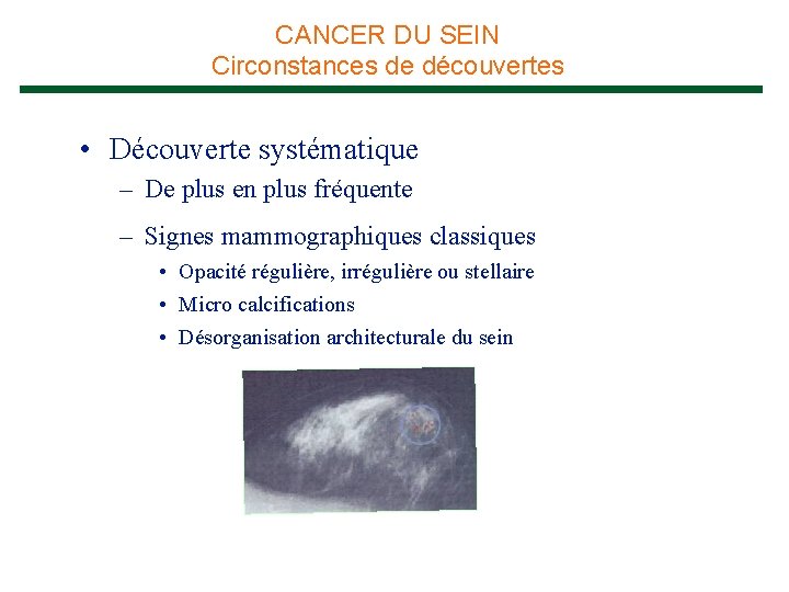 CANCER DU SEIN Circonstances de découvertes • Découverte systématique – De plus en plus