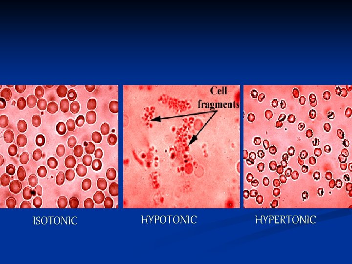 ISOTONIC HYPERTONIC 