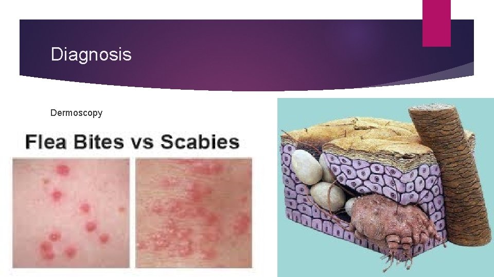 Diagnosis Dermoscopy 