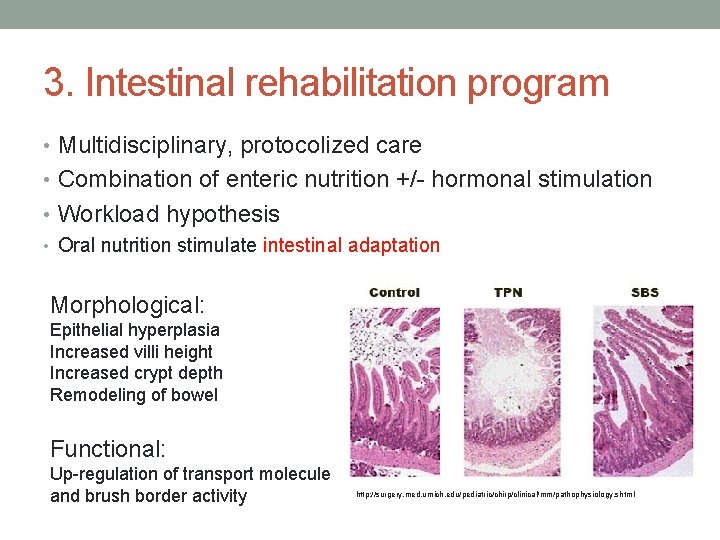 3. Intestinal rehabilitation program • Multidisciplinary, protocolized care • Combination of enteric nutrition +/-