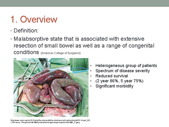 1. Overview • Definition: • Malabsorptive state that is associated with extensive resection of