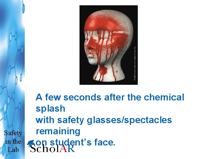 Safety in the Lab A few seconds after the chemical splash with safety glasses/spectacles