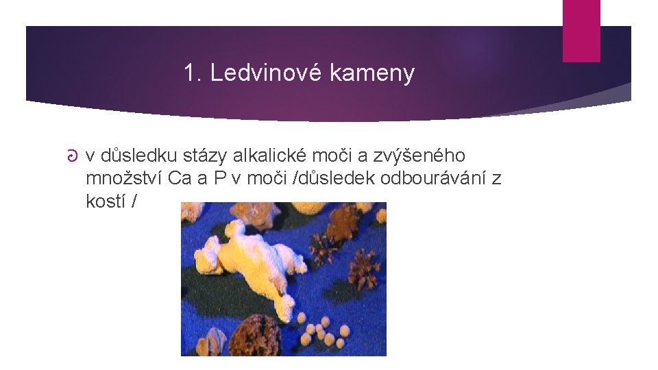 1. Ledvinové kameny ᘒ v důsledku stázy alkalické moči a zvýšeného množství Ca a