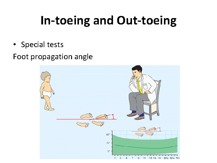 In-toeing and Out-toeing • Special tests Foot propagation angle 