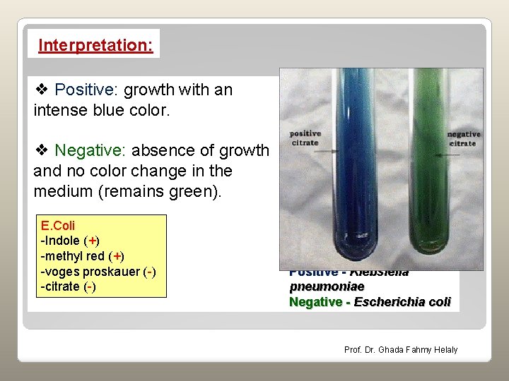 Interpretation: ❖ Positive: growth with an intense blue color. ❖ Negative: absence of growth