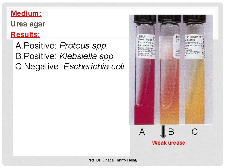 Medium: Urea agar Results: A. Positive: Proteus spp. B. Positive: Klebsiella spp. C. Negative: