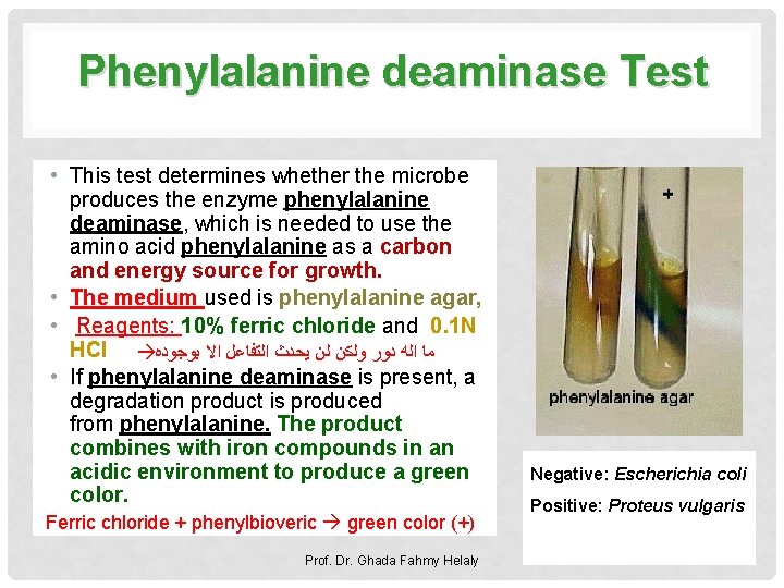 Phenylalanine deaminase Test • This test determines whether the microbe produces the enzyme phenylalanine