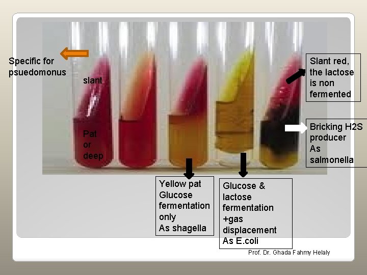 Specific for psuedomonus slant Slant red, the lactose is non fermented Pat or deep