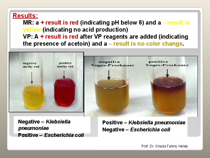 Results: MR: a + result is red (indicating p. H below 6) and a