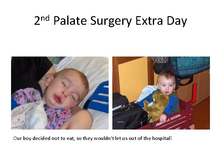 2 nd Palate Surgery Extra Day Our boy decided not to eat, so they