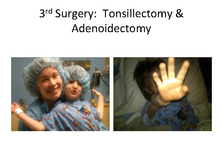 3 rd Surgery: Tonsillectomy & Adenoidectomy 