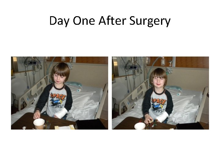 Day One After Surgery 