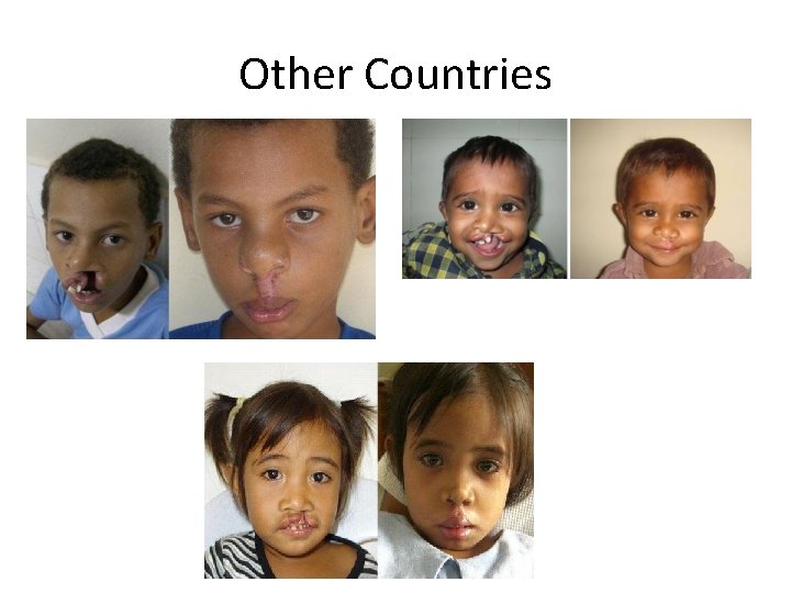 Other Countries 