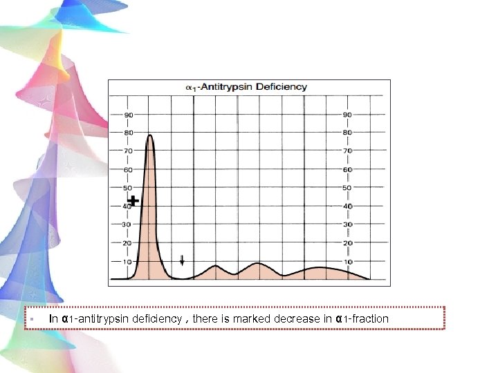 § In α 1 -antitrypsin deficiency , there is marked decrease in α 1