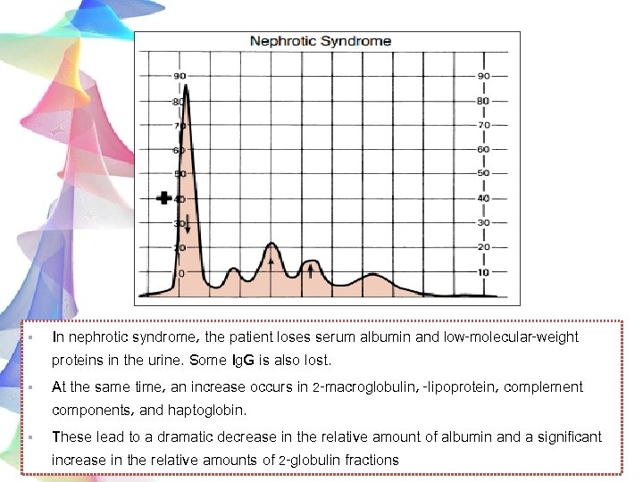 § In nephrotic syndrome, the patient loses serum albumin and low-molecular-weight proteins in the